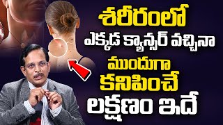 ఒంట్లో కాన్సర్ కణాలు ఉంటె కనిపించే సూచనలు | Dr.D Ram Mohan Reddy About Cancer symptoms | iD Health