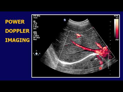 POWER DOPPLER - YouTube