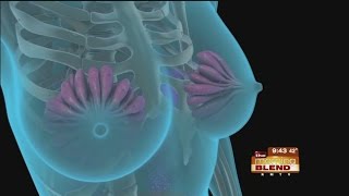 Relief for Breast Pain