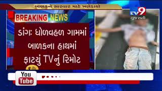 Dang: 9 year old injured after TV remote explodes- Tv9