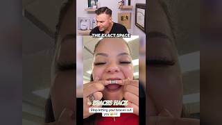 This Braces Hack Is Actually GOOD?! 🙌🦷