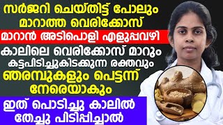 സർജ്ജറി ചെയ്തിട്ടും മാറാത്ത വെരിക്കോസ് വെയ്ൻ മാറാൻ എളുപ്പവഴി | vericose vein maaraan malayalam