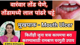 वारंवार तोंड येणे,चट्टे(mouth ulcer) कारणे,त्वरित आराम देणारे रामबाण घरगुती उपाय Tond yene upay