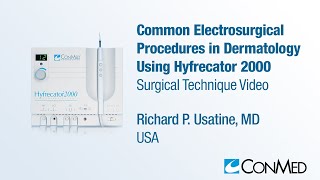 Dr. Richard Usatine - Common Dermatologic Procedures Using Hyfrecator® 2000 - CONMED Technique