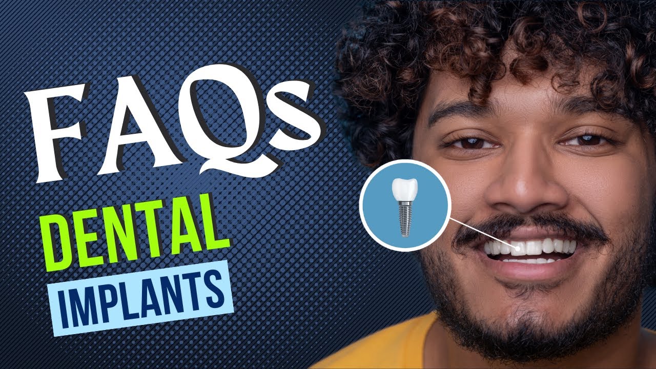 Dental Implants Faqs Youtube