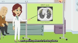 What is an HRCT scan