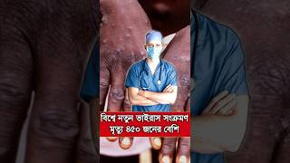 এমপক্স ভাইরাস কতটা ভয়ংকর | ছড়িয়ে পড়েছে  আফ্রিকায় |  m pox virus | New Virus In World