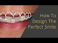 Designing the Perfect Veneers or All on 4 Smile