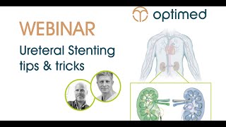 Ureteral Stenting - Live Webinar recording from 24.11.2022