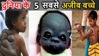 दुनिया के 5 सबसे अजीब बच्चे amazing facts   children xnxx