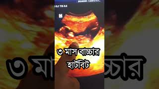 ৩ মাস বাচ্চার হার্টবিট #pregnancy #usg #viral