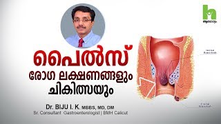 പൈൽസ് രോഗ ലക്ഷണങ്ങളും ചികിത്സയും | How to get rid of piles | Malayalam health tips