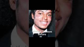 Plastic Surgery Disasters