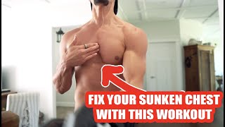 Try this At home Workout to Fix Pectus