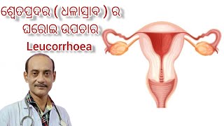 ଶ୍ବେତପ୍ରଦର ( ଧଳାସ୍ରାବ ) ର ଘରୋଇ ଉପଚାର | leukorrhea