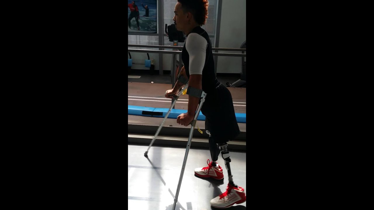 Double Amputee Above The Knee Walking With My New Prosthetics - YouTube