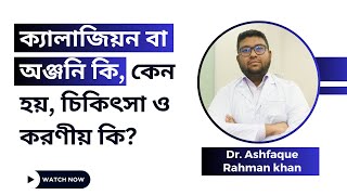 ক্যালাজিয়ন বা অঞ্জনি কি, কেন হয়, চিকিৎসা ও করণীয় কি?