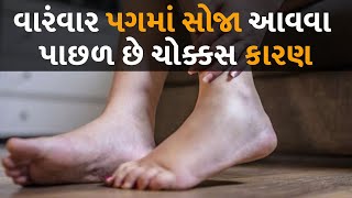 વારંવાર પગમાં સોજા આવવા પાછળ છે ચોક્કસ કારણ #health #swelling #legswelling #reason