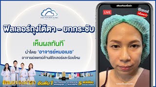 รีวิวจากคนไข้จริง - คุณอ้อม ฉีดฟิลเลอร์แก้ปัญหาถุงใต้ตาและยกกระชับกับอาจารย์หมอเมฆที่DoctorMekClinic