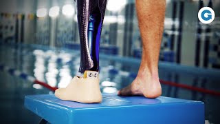 Beyond Limits: The Evolution and Enhancement of Prostheses