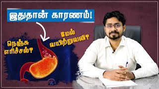 நெஞ்சு எரிச்சல் மேல் வயிற்றுவலிக்கு இதுதான் காரணம்! | Dr. Bala Murugan