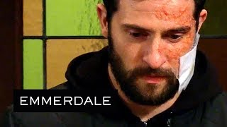 Emmerdale - Ross Becomes the Victim of a Horribly Cruel Bet