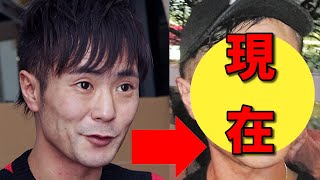 カラテカ・入江慎也、今現在の状況がヤバすぎると話題に！