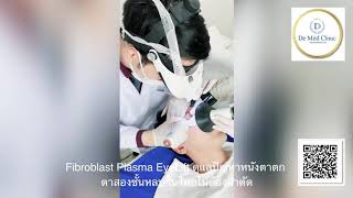 แก้ปัญหาหนังตาตก ตาสองชั้นหลบในโดยไม่ต้องผ่าตัดด้วย Fibroblast Plasma EyeLift