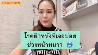 โรคผิวหนังที่พบบ่อยในหน้าหนาว part 1 | สุกใส, งูสวัด | คุณหมอขาา EP.23