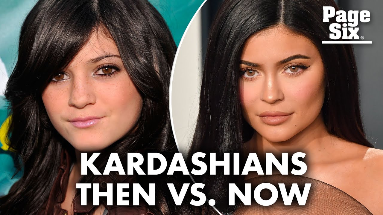 The Kardashian-Jenner Faces Before And After Stardom | Page Six ...