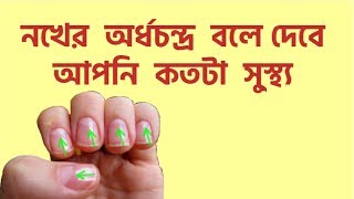 নখ বলবে আপনার স্বাস্থ্য | your nail tells about your health | b2unews channel