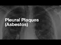 Asbestos-Related Pleural Plaques