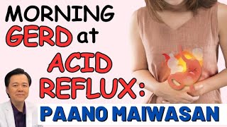 Morning GERD at Acid Reflux: Paano Maiwasan. - By Doc Willie Ong (Internist and Cardiologist)