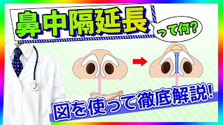 【鼻整形】鼻中隔延長とは？鼻尖形成との違いについても解説！