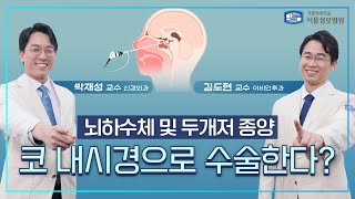 뇌하수체 및 두개저 종양, 코 내시경으로 수술한다? | 서울성모병원 김도현, 박재성 교수