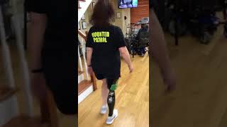 Above Knee Amputee Walks Extremely Well