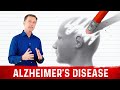 What is Alzheimer's Disease? – Causes, Symptoms & Treatment Simplified by Dr. Berg