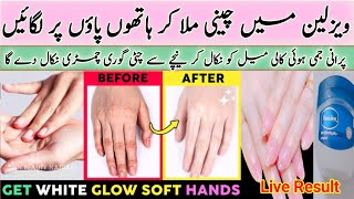 How to Remove Wrinkles from hand | How I Keep My Hand Soft, Wrinkle Free, Smooth And Younger Looking