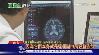 不注意這幾件事...導致「腦溢血」...醫師:致死風險高!｜十點不一樣20220111