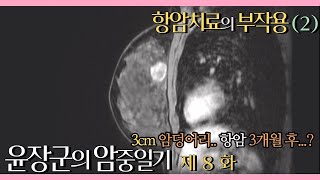 제8화 - TC 항암 부작용 2편 l 중간검진 결과 l 윤장군의 암중일기