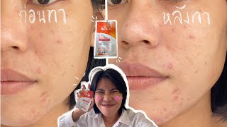 รีวิวครีมกันแดด KA WHITENING SOFT CREAM สูตรคุมมัน กันแดดคุมมันเนื้อบางเบา | plakritsana