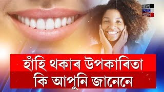 আপুনি বাৰু হাঁহি ভাল পায় নেকি? হাঁহি থকাৰ উপকাৰিতা কি আপুনি জানেনে?