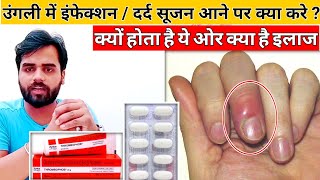 ऊँगली में सूजन,दर्द,लाल,होने के क्या कारण है कैसे इलाज करे ?/ ungli mein infection | Medical jankari