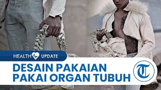 Buntut Dugaan Pembelian Organ Manusia oleh Desainer Indonesia, Polri Koordinasi dengan Interpol