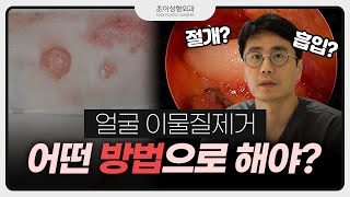 [EN/JP/CN] 얼굴 이물질 직접 보면서 제거하는 이유