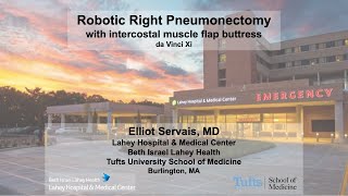 Robotic right pneumonectomy