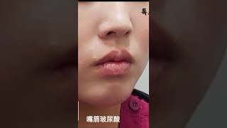 [特秀恩碧·江南本院]嘴角下垂？ 看著很凶？ 最近流行的微笑唇帶給您迷人般的微笑 😄