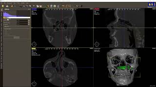 DDS-Pro 004 - STL object import centered