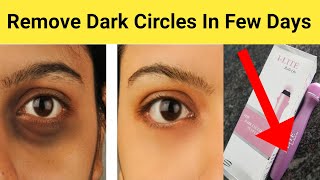 Dark Circles Removal Lotion || I Lite Roll On || Dark Circles Treatment