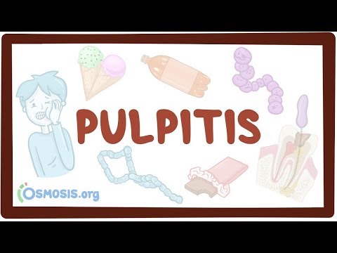 What are the two basic forms of Pulpitis?